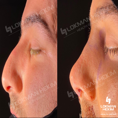 fotos antes y después de nuestros pacientes 9